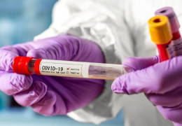 За добу в області зафіксували 304 нових випадків зараження COVID-19
