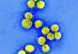 РНК коронавіруса знайшли на килимі і в кондиціонері через місяць після одужання мешканців будинку