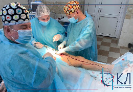 У Чернівцях судинні хірурги обласної клінічної лікарні видалили з ноги постковідної пацієнтки понад метровий тромб