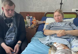 Українка, яку розстріляв російський солдат. "Лікарі не кажуть, скільки в мені було куль"