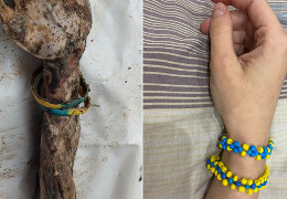 “Це міг бути кожен із нас”: українці поширюють у соцмережах фото руки закатованої людини з браслетом з Ізюма (ОНОВЛЕНО)