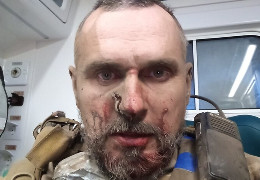 Режисер Олег Сенцов отримав поранення на фронті