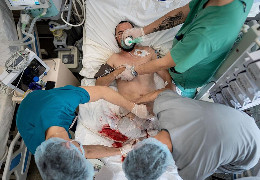 50-100 операцій за ніч: як лікарня ім. Мечникова у Дніпрі рятує українських військових