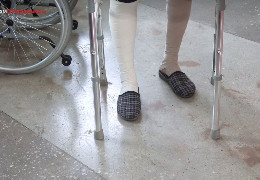 Пацієнтам у Чернівцях роблять безкоштовне протезування: і військовим, і цивільним