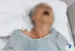У Бразилії жінка шокувала працівника крематорію, коли “воскресла” у лікарняному морзі