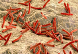 У двох масажисток СПА-центру у румунському місті Клуж виявили проказу