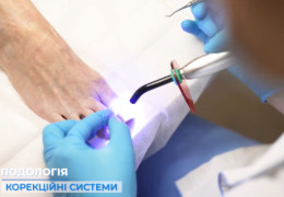 Як лікувати врослий ніготь